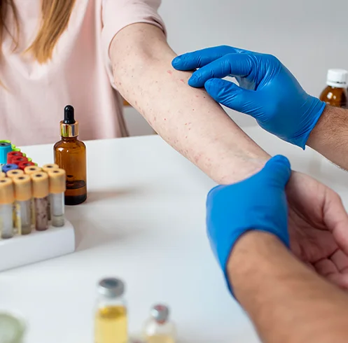 Allergy Test - General Dubai