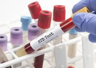 STD Screening Profiles: From Simple Checkups to Full Sexual Health Panels