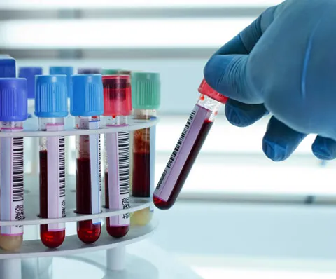 Custom Blood Test Dubai